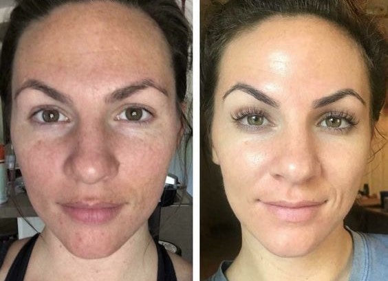 Retinol Pads 0.50%