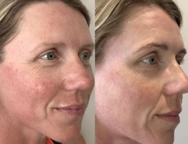 Radiant Vitamin C Cream