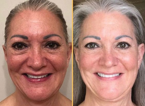 Retinol Pads 0.50%