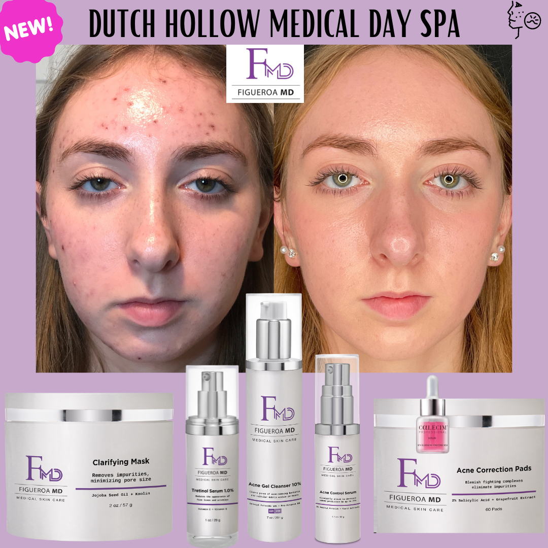 Acne Defense Kit