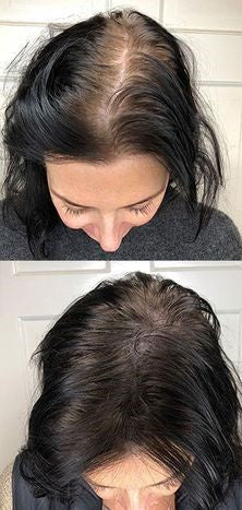 Advanced Hair Growth System
