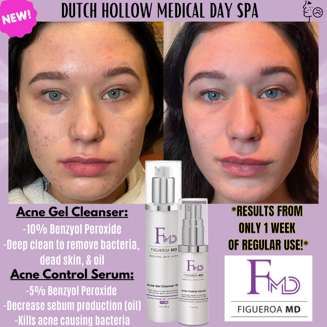 Acne Gel Cleanser 5%
