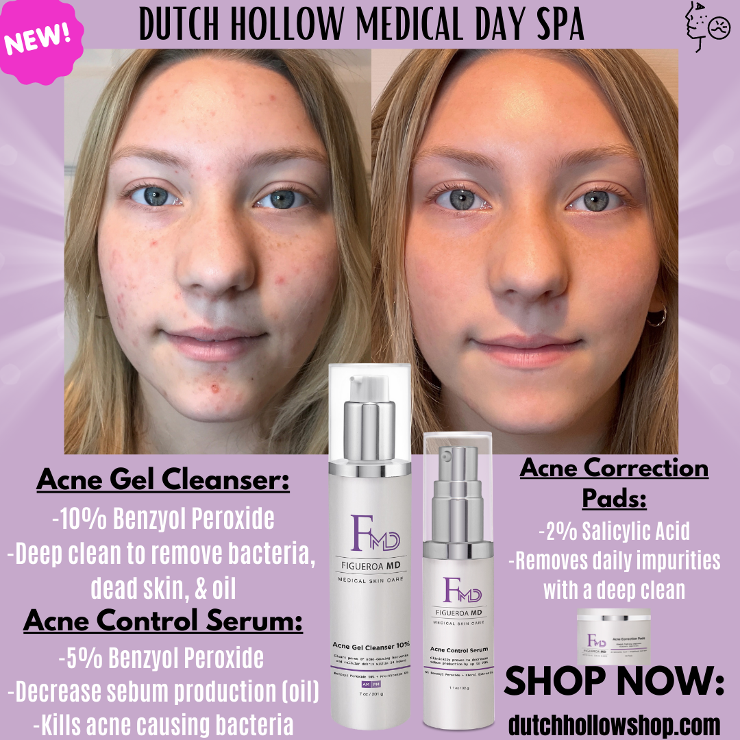 Acne Gel Cleanser 5%