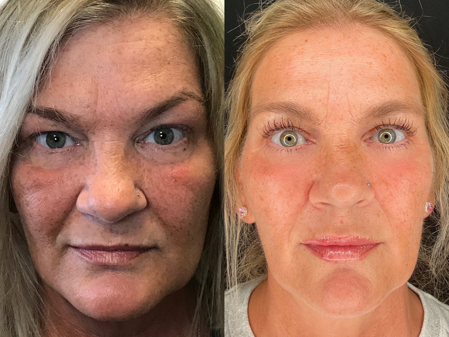 Peptide Growth Factor