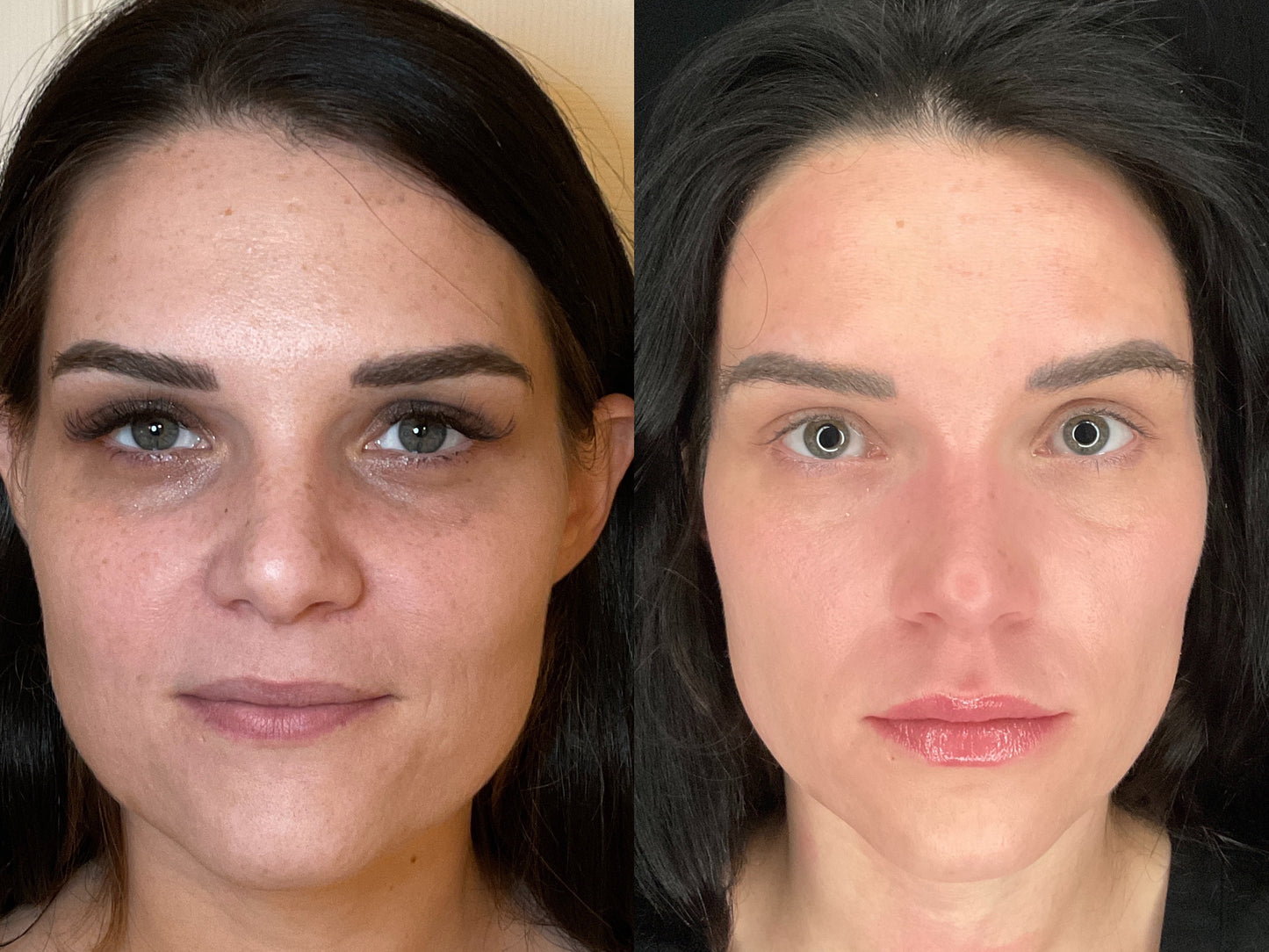 Vitamin CE Serum