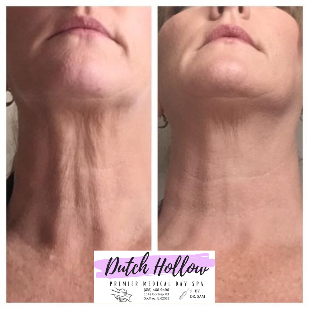 Age Reversal Neck Cream