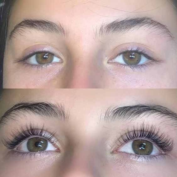 Lash & Brow Growth Serum